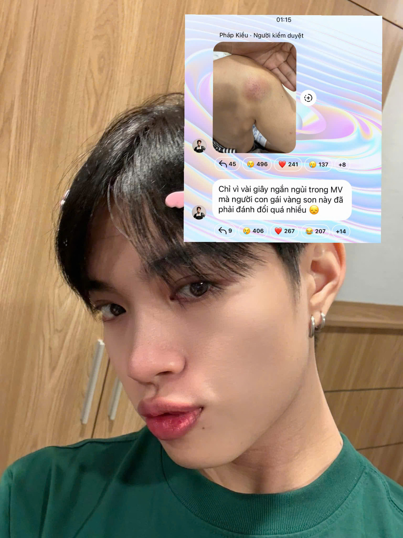 Pháp Kiều chia sẻ mình bị trấn thương trong quá trình tập luyện. Pháp Kiều chia sẻ mình bị trấn thương trong quá trình tập luyện.