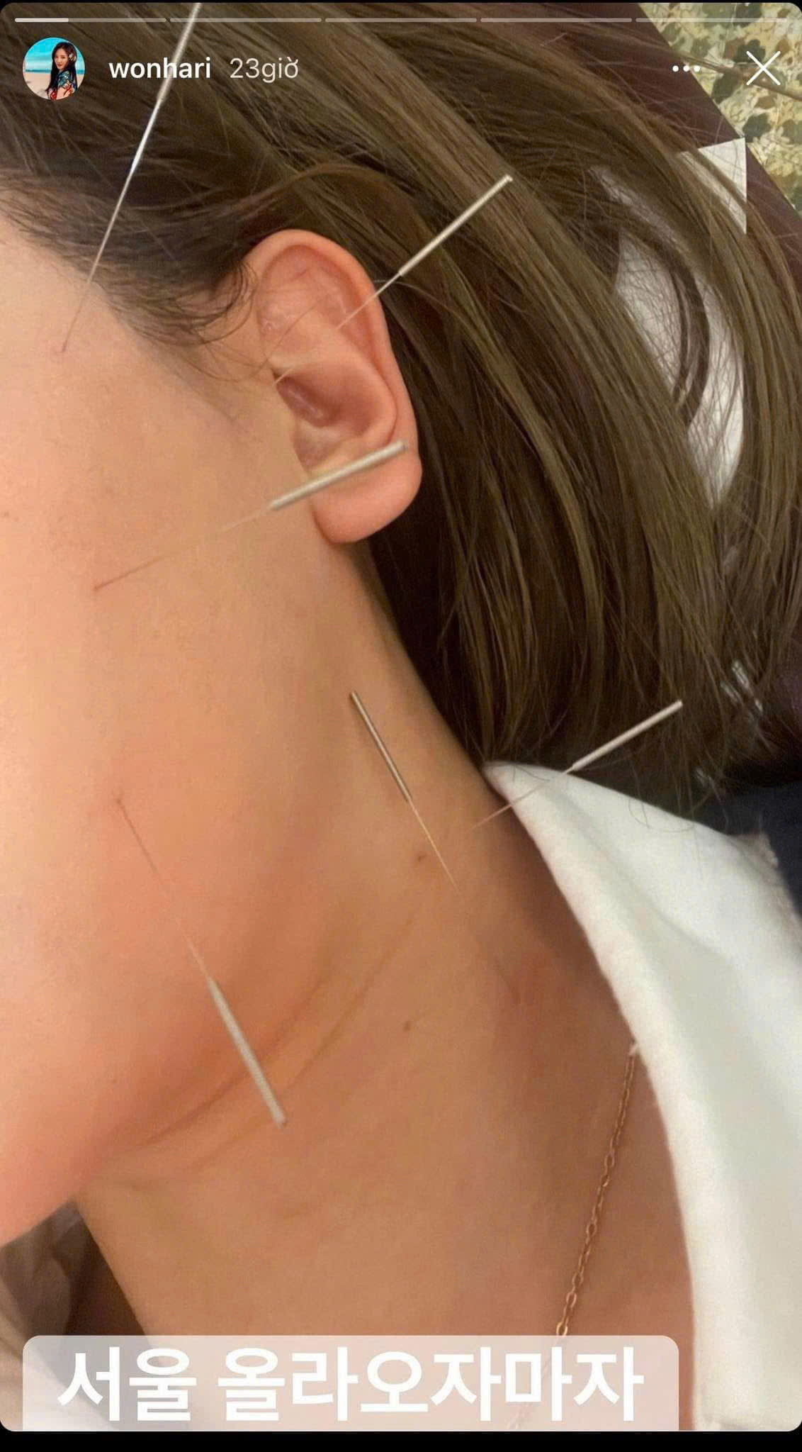 Nữ ca sĩ sau đó đã lấy lại tinh thần và cố gắng điều trị dứt điểm. Nữ ca sĩ sau đó đã lấy lại tinh thần và cố gắng điều trị dứt điểm.