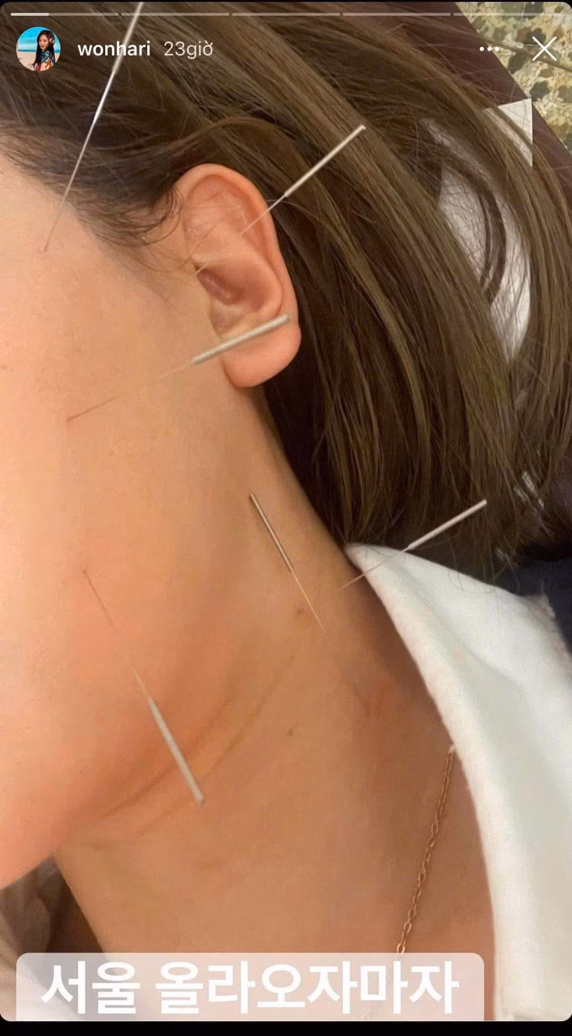 Nữ ca sĩ sau đó đã lấy lại tinh thần và cố gắng điều trị dứt điểm.