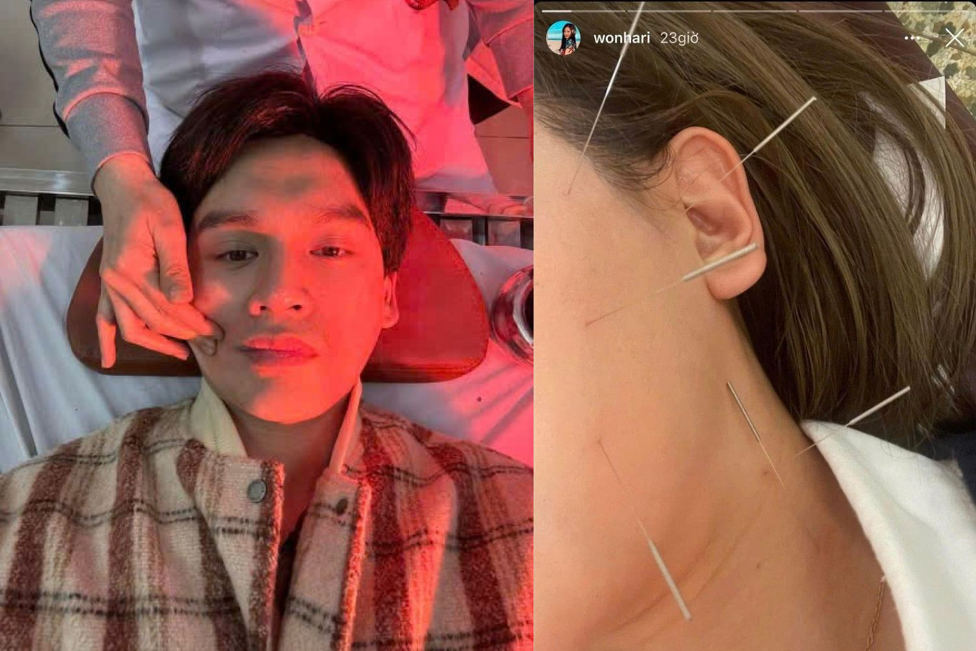 Nguyễn Trần Trung Quân, Hari Won cũng từng mắc căn bệnh tương tự. Nguyễn Trần Trung Quân, Hari Won cũng từng mắc căn bệnh tương tự.