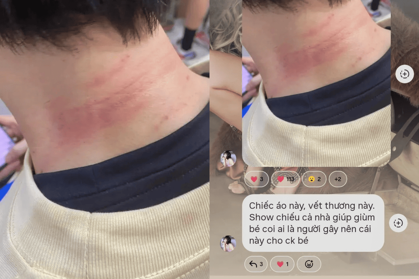 Atus và vết thương ở cổ khiến Diệu Nhi phải &quot;truy tìm hung thủ&quot;.