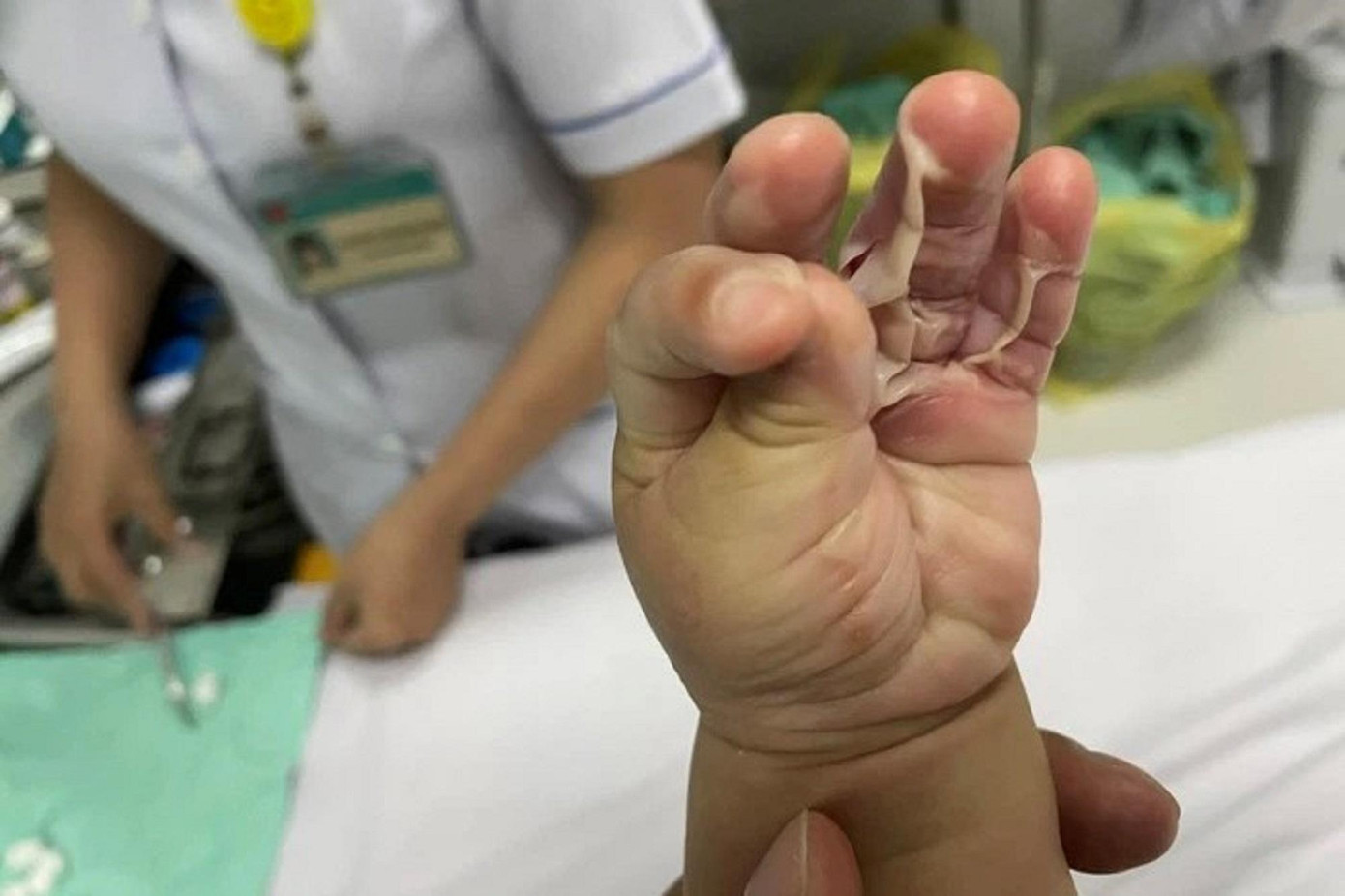 Gia đình cho rằng thuốc điều trị bỏng cho bệnh nhi là không phù hợp khiến bé bị viêm dạ dày cấp Gia đình cho rằng thuốc điều trị bỏng cho bệnh nhi là không phù hợp khiến bé bị viêm dạ dày cấp