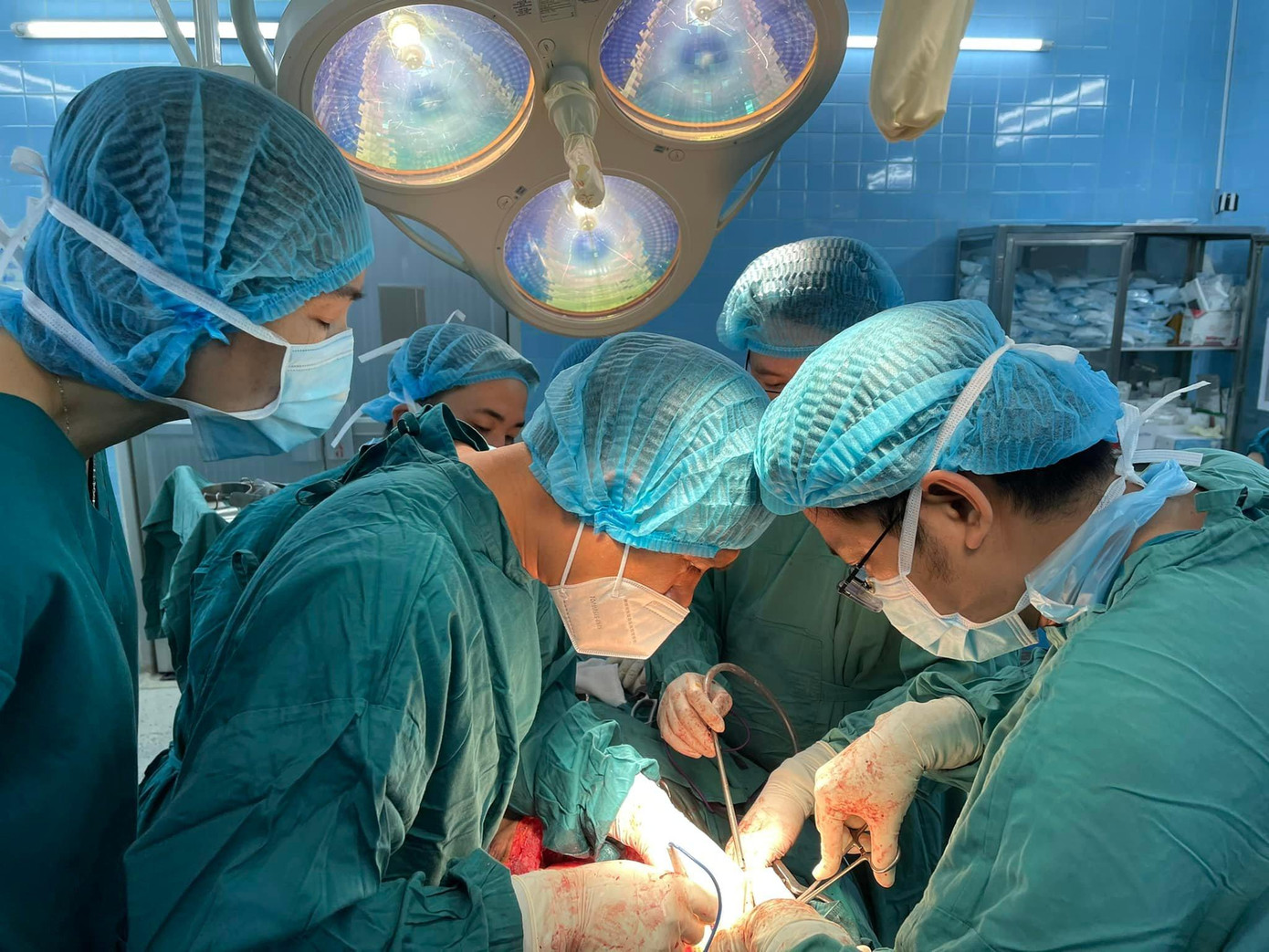 Ê kíp phẫu thuật đã căng mình bóc tách thành công khối bướu ra khỏi cơ thể bệnh nhân Ê kíp phẫu thuật đã căng mình bóc tách thành công khối bướu ra khỏi cơ thể bệnh nhân