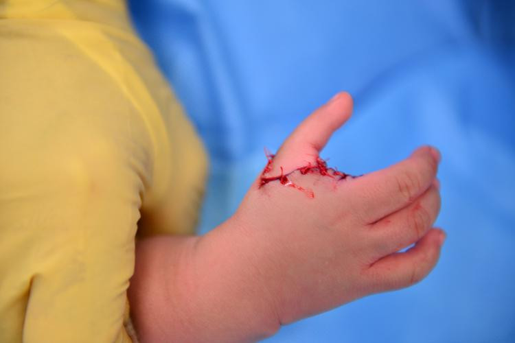 Người được mệnh danh là phù thủy của những bàn tay đang mang lại cuộc đời mới cho nhiều trẻ bất hạnh Người được mệnh danh là phù thủy của những bàn tay đang mang lại cuộc đời mới cho nhiều trẻ bất hạnh