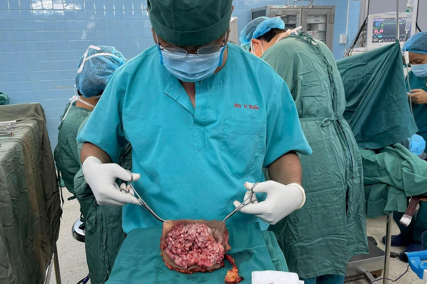Khối u có trọng lượng 2kg được bác sĩ bóc tách thành công khỏi cơ thể người bệnh (ảnh: BSCC) Khối u có trọng lượng 2kg được bác sĩ bóc tách thành công khỏi cơ thể người bệnh (ảnh: BSCC)