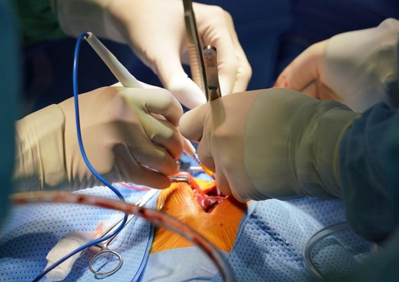 Mỗi năm tại Việt Nam có khoảng 10.000 đến 15.000 trẻ sinh ra bị bệnh tim bẩm sinh