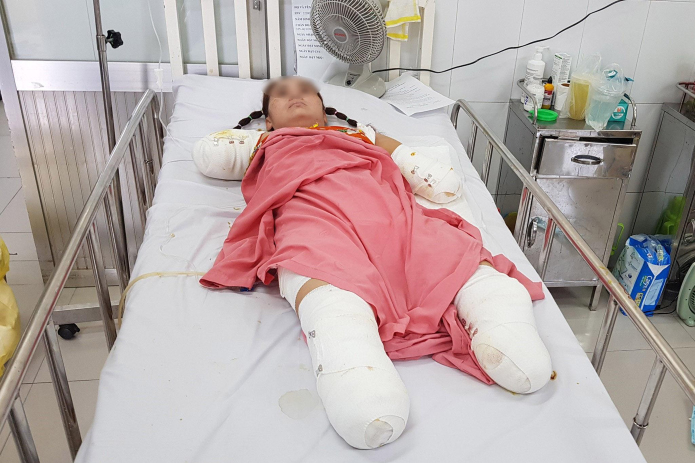 Tai nạn điện đã khiến người bệnh vĩnh viễn mất cả tứ chi Tai nạn điện đã khiến người bệnh vĩnh viễn mất cả tứ chi