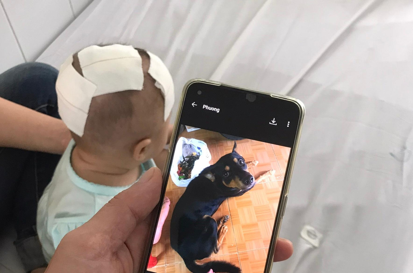 Chú chó được xem là thú cưng của gia đình đã tấn công, cắn xuyên hộp sọ bé gái Chú chó được xem là thú cưng của gia đình đã tấn công, cắn xuyên hộp sọ bé gái