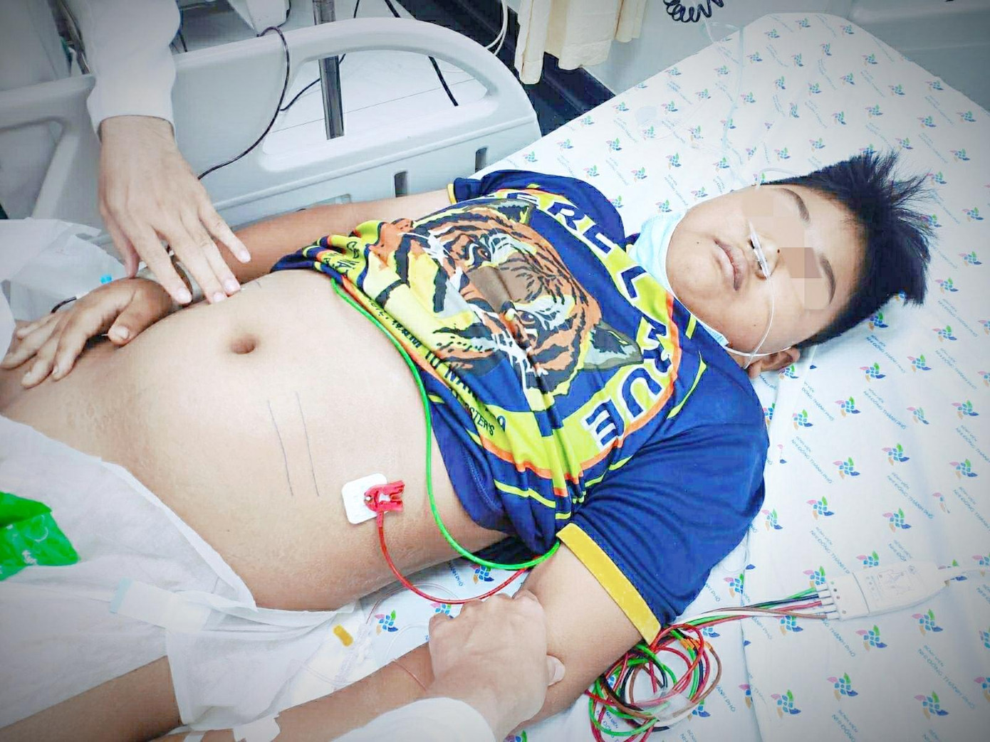 Bệnh nhân nhập viện trong tình trạng da nhợt nhạt, tím tái do mất máu cấp trên cơ địa mắc sốt xuất huyết Bệnh nhân nhập viện trong tình trạng da nhợt nhạt, tím tái do mất máu cấp trên cơ địa mắc sốt xuất huyết