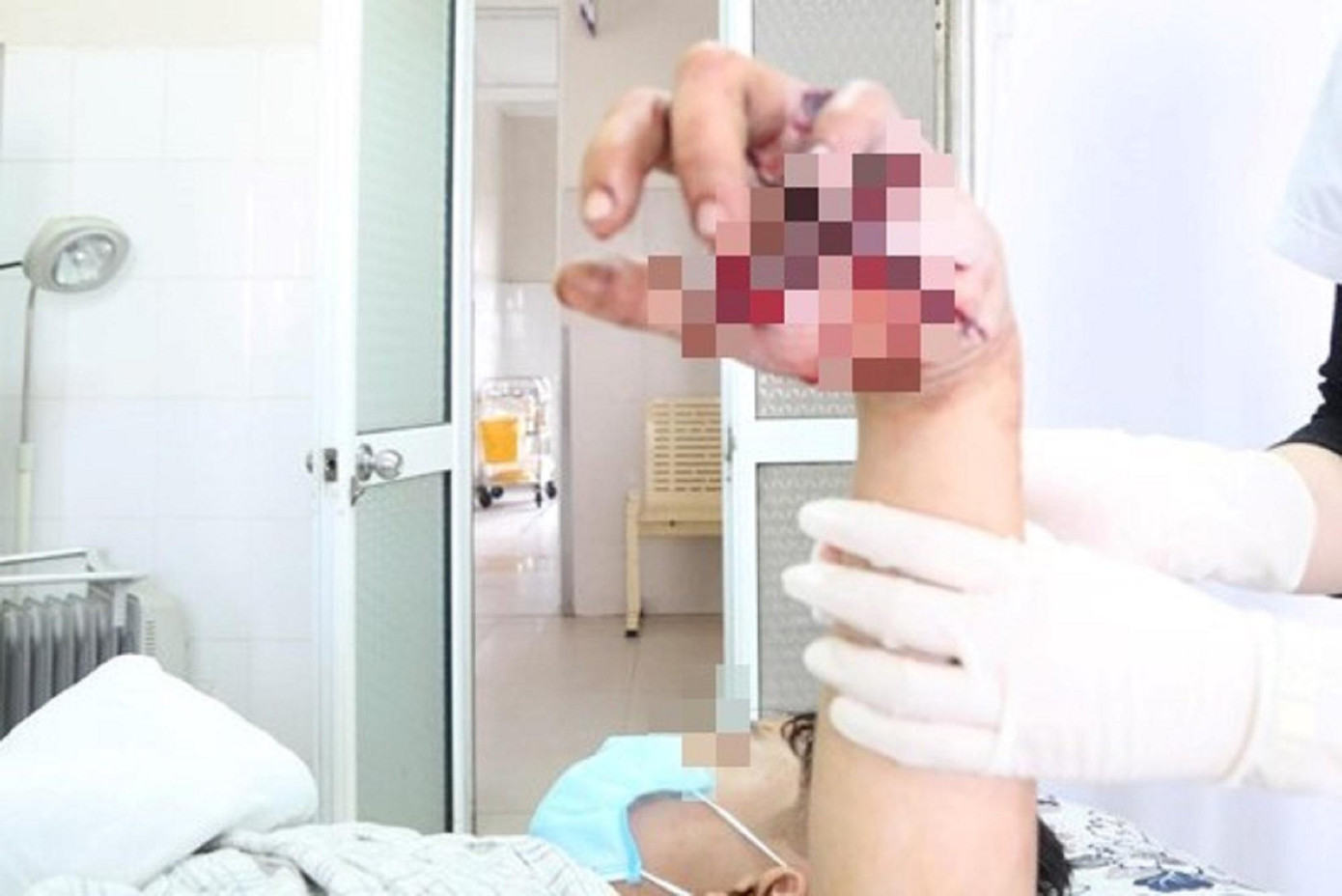 Nhiều trẻ đã gặp nạn do chơi pháo tự chế trong những ngày Tết vừa qua Nhiều trẻ đã gặp nạn do chơi pháo tự chế trong những ngày Tết vừa qua