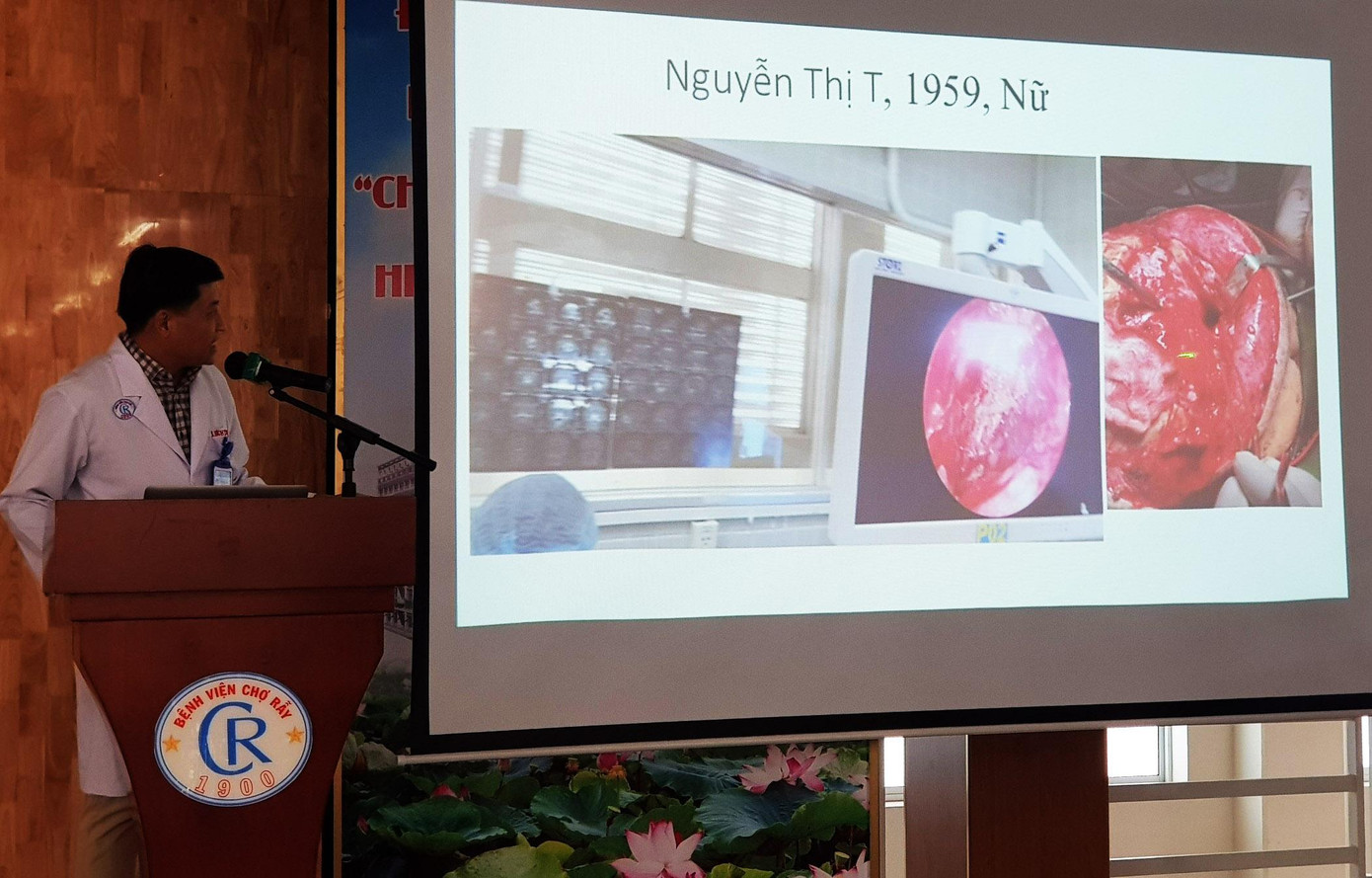 TPHCM: Hàng loạt trường hợp chết xương vùng đầu mặt hậu COVID-19 ảnh 1