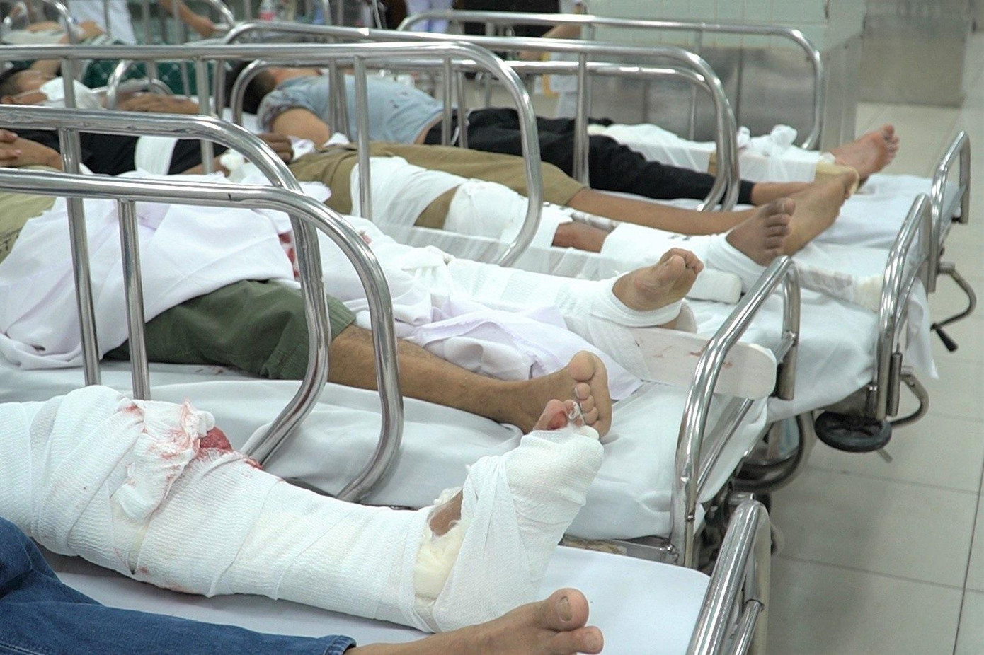 Tai nạn, thương tích nghiêm trọng khiến nhiều trường hợp phải phẫu thuật cấp cứu Tai nạn, thương tích nghiêm trọng khiến nhiều trường hợp phải phẫu thuật cấp cứu