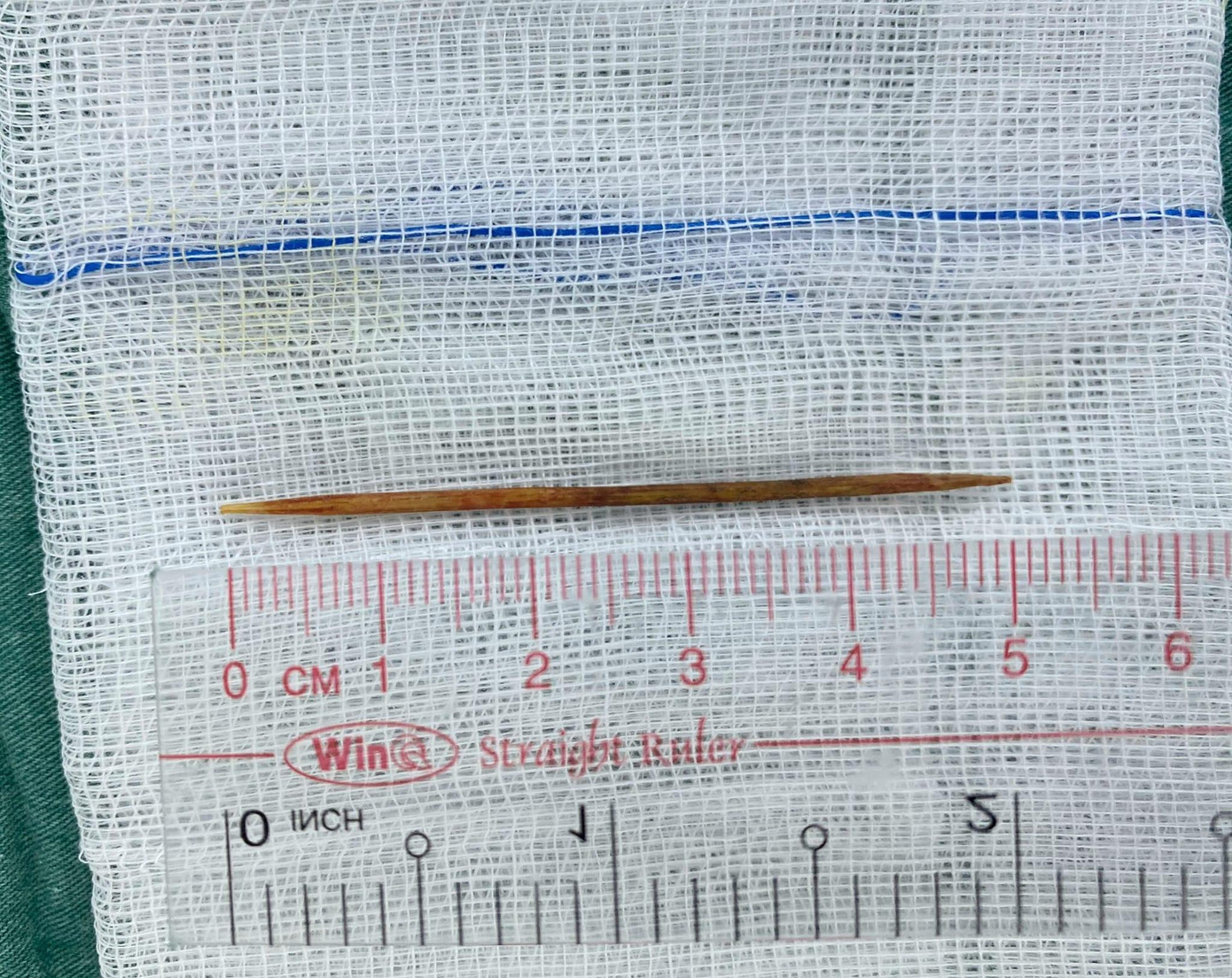 Chiếc tăm xỉa răng dài 5cm là "thủ phạm" đâm thủng nhiều vị trí nội tạng của bệnh nhi Chiếc tăm xỉa răng dài 5cm là "thủ phạm" đâm thủng nhiều vị trí nội tạng của bệnh nhi