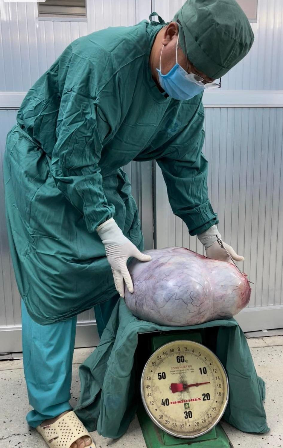 Bác sĩ kiểm tra trọng lượng của khối u sau cuộc phẫu thuật Bác sĩ kiểm tra trọng lượng của khối u sau cuộc phẫu thuật