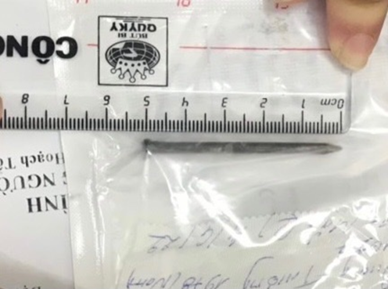 Các bác sĩ đã thực hiện phẫu thuật lấy thành công chiếc đinh kim loại dài 5cm ra khỏi mắt người bệnh
