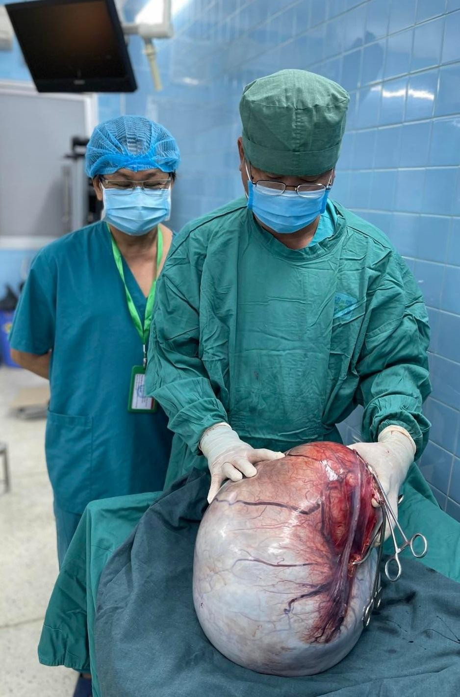 Khối u có kích thước rất lớn đã chèn ép nhiều bộ phận nội tạng của nữ bệnh nhân Khối u có kích thước rất lớn đã chèn ép nhiều bộ phận nội tạng của nữ bệnh nhân