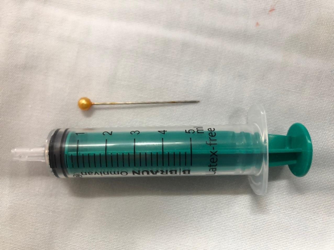 Các bác sĩ đã thực hiện nội soi lấy thành công cây kim ra khỏi đường thở bệnh nhi