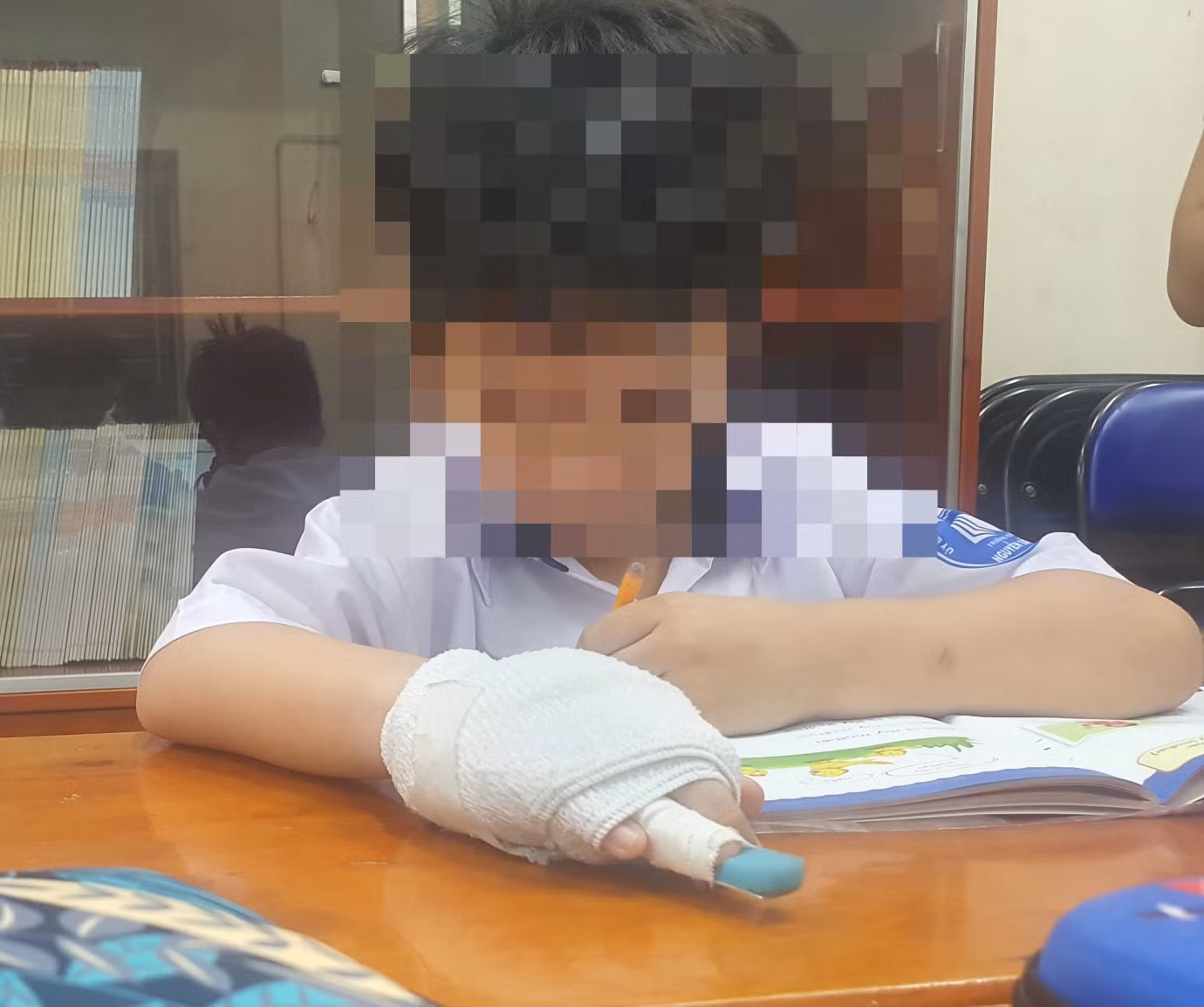 Hình ảnh ngón tay học sinh bị gãy nghi do cô giáo đánh (ảnh PHCC)