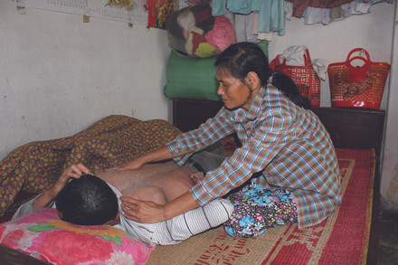 Căn bệnh khiến da 3 anh em nhà họ Trương luôn kết thành vảy, rơi lả tả. Ảnh: Lao Động