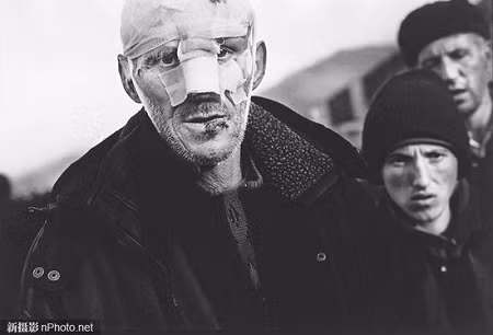 1999: Một người đàn ông Kosovo trên đường phố thị trấn Kukes, Albania. Đây là một trong những nơi tập trung khá đông người tị nạn gốc Albani sơ tán khỏi khu vực bạo lực ở Kosovo
