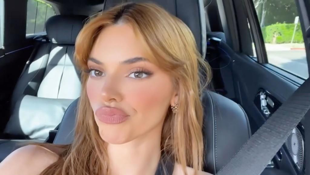 Sau khi đổi màu tóc, "siêu mẫu đắt giá nhất hành tinh" Kendall Jenner lại gây chú ý với đôi môi "cá trê" nghi do tiêm chất làm đầy để giúp môi dày và mọng hơn.