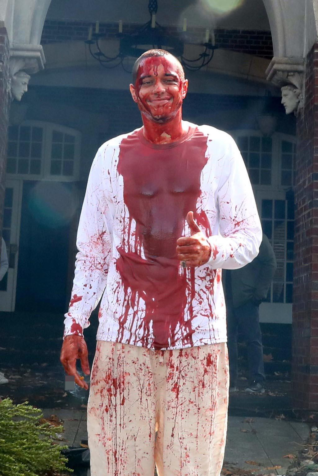 Tình 9x của Kim Kardashian, Pete Davidson, gây sốc với hình ảnh máu me be bét. "Kanye West không phải chịu trách nhiệm về tình trạng đẫm máu của Pete Davidson. Anh ấy vừa quay một bộ phim mới - The Home", Page Six bình luận.