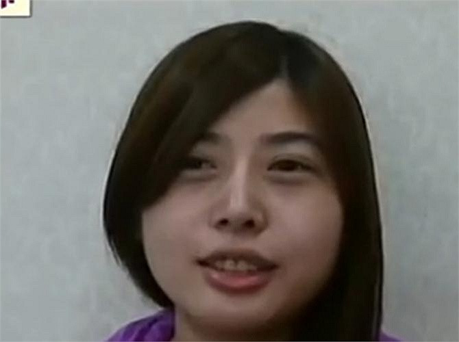 Cô đã từng thử xoa bóp nâng mặt, thậm chí tiêm tạo hình