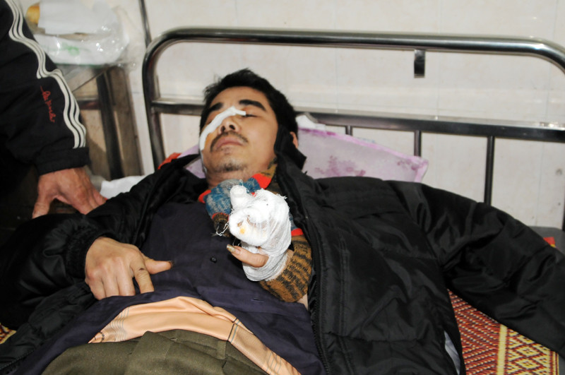 Anh Phạm Văn Dương đang điều trị vết thương tại bệnh viện huyện Thường Tín. Ảnh: Tuấn Nguyễn