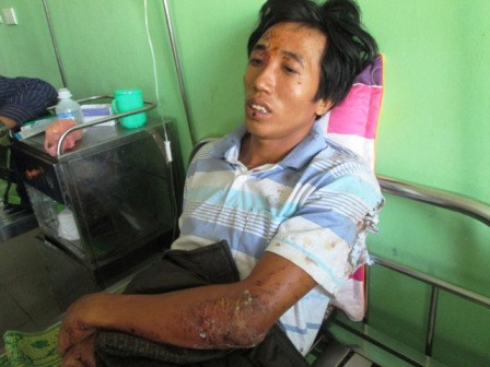 Anh Phạm Văn Bắc thất thần kể lại sự việc