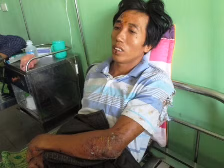 Anh Phạm Văn Bắc thất thần kể lại sự việc