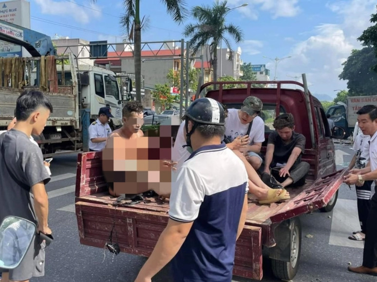 Theo ghi nhận ban đầu, vụ nổ đã làm khoảng 5 người bị thương. Người dân hỗ trợ, đưa nạn nhân đi cứu thương. Ảnh: Báo Giao Thông