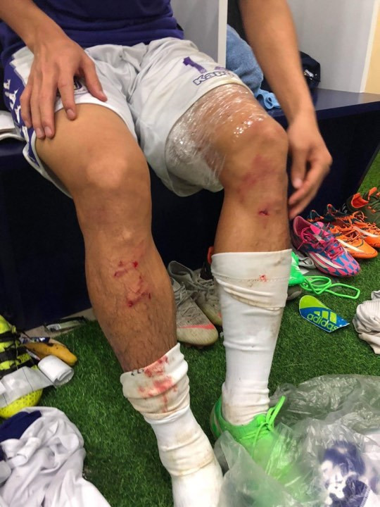 Quế Ngọc Hải bị tố vào bóng triệt hạ đồng nghiệp ảnh 1