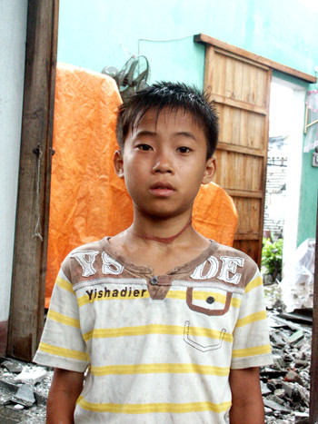 Cháu Hoàng (14 tuổi) suýt chết vẫn bị thương ở cổ, đứng trong ngôi nhà đổ nát của gia đình