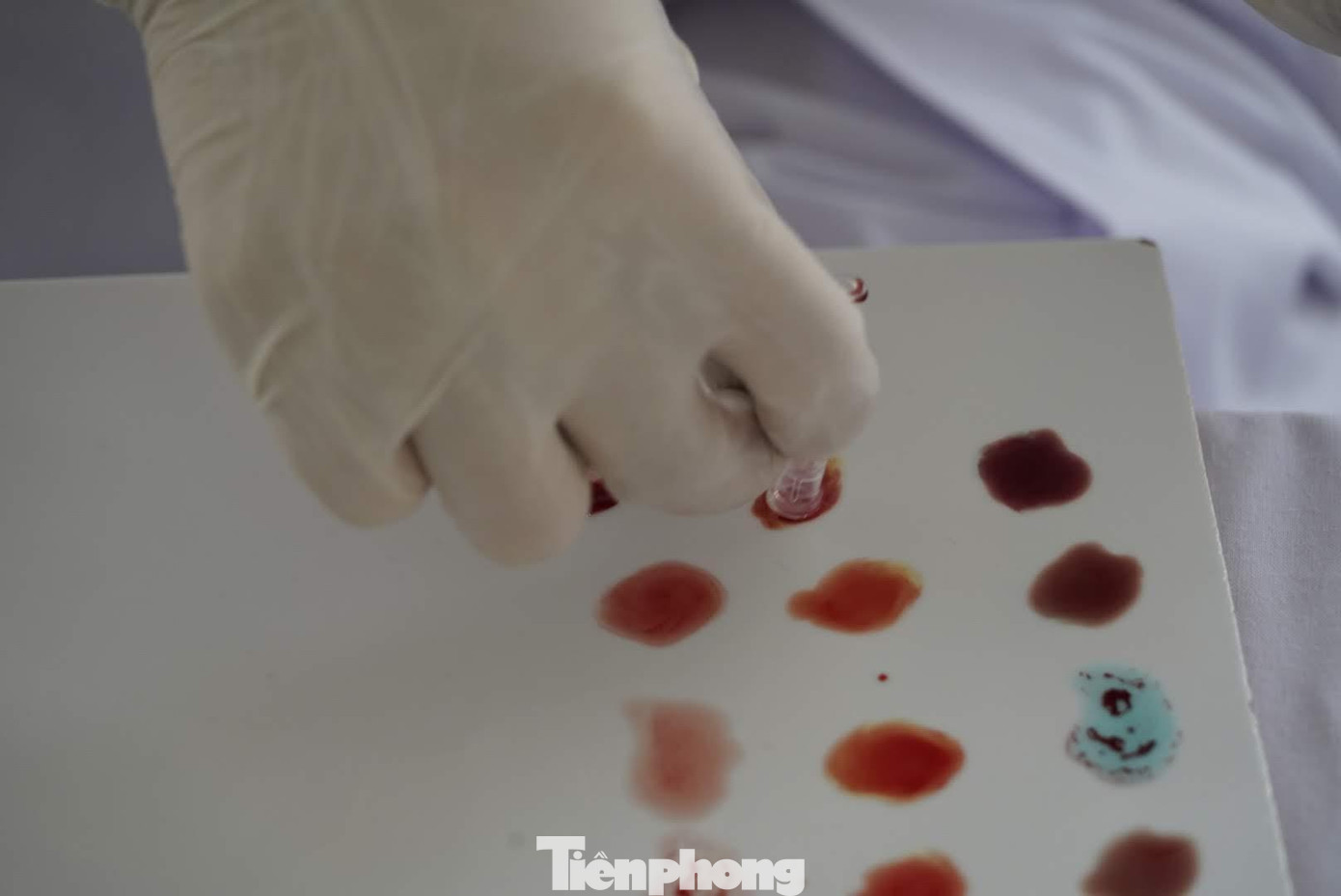 Cứ mỗi dịp Tết đến, lượng máu tại các bệnh viện tuyến tỉnh thường xuyên bị thiếu hụt. Chương trình Chủ nhật Đỏ do báo Tiền Phong tổ chức đã bổ sung vào ngân hàng máu số lượng máu cần thiết cho người bệnh.