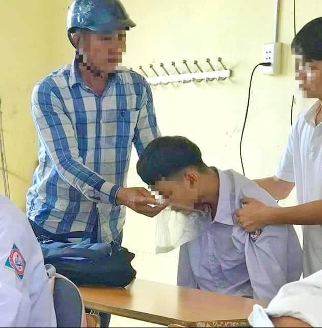 Chỉ sau 15 phút cả 7 bạn cùng hút đều có biểu hiện chóng mặt và nôn mửa và sau đó được đưa đi cấp cứu. Chỉ sau 15 phút cả 7 bạn cùng hút đều có biểu hiện chóng mặt và nôn mửa và sau đó được đưa đi cấp cứu.