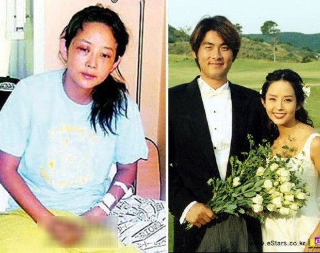 Hình ảnh Choi Jin Sil bị chồng bạo hành gây sốc dư luận. Hình ảnh Choi Jin Sil bị chồng bạo hành gây sốc dư luận.