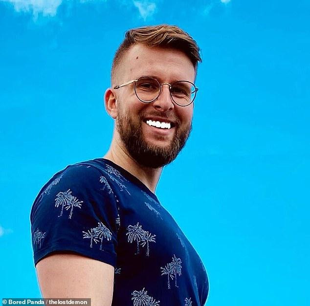 Người đàn ông đến Mỹ muốn có hàm răng trắng đều như ngọc. Tuy nhiên, việc chỉnh sửa quá đà khiến anh bị dân mạng chế nhạo.