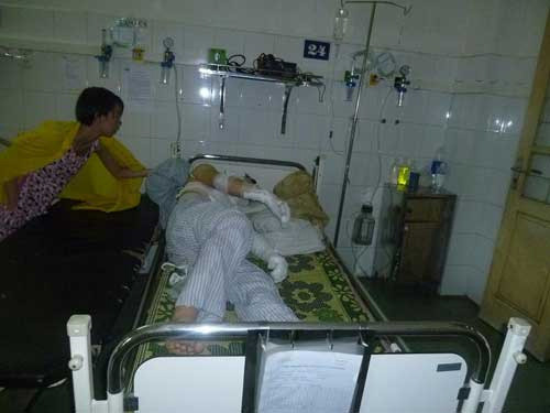  Có 5 trẻ em bị bỏng trong vụ nổ bóng 