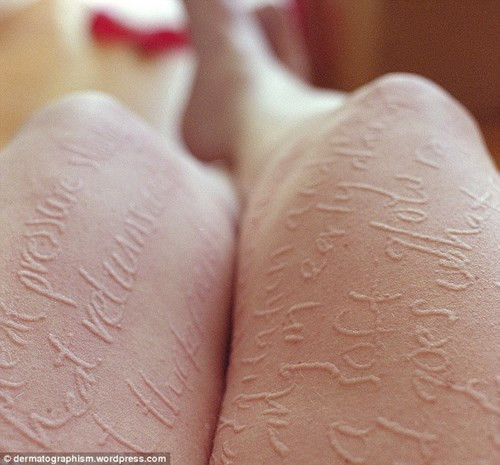 Những căn bệnh có một không hai trên thế giới