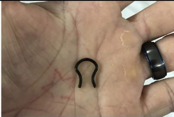 Chiếc khuyên mũi được lấy ra. Ảnh: Facebook. Chiếc khuyên mũi được lấy ra. Ảnh: Facebook.