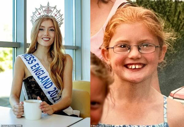 Jessica đúng là đã dậy thì vô cùng thành công. Ảnh: Joseph Walshe/ SWNS. Jessica đúng là đã dậy thì vô cùng thành công. Ảnh: Joseph Walshe/ SWNS.