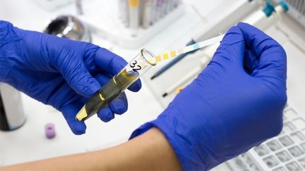 Cảnh sát Hàn đã làm việc rất tích cực khi phân tích kỹ mẫu chất lỏng trong chiếc túi. Ảnh minh họa: WTE.