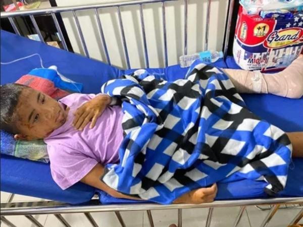 Người ta gọi việc Hasme sống sót là một "kỳ tích". Ảnh: ViralPress. Người ta gọi việc Hasme sống sót là một "kỳ tích". Ảnh: ViralPress.