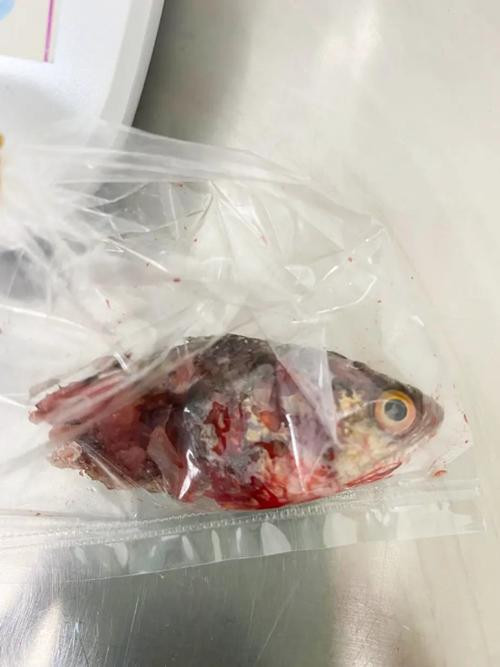 Một phần của con cá được các bác sĩ lôi ra. Ảnh: ViralPress.