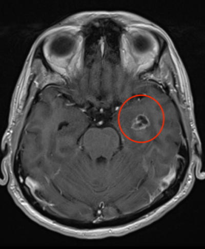 Hóa ra đây là thủ phạm gây ra những cơn cáu kỉnh của Sadayan. Ảnh: Sadayan Maideen. Hóa ra đây là thủ phạm gây ra những cơn cáu kỉnh của Sadayan. Ảnh: Sadayan Maideen.