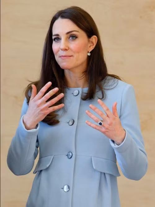 Có lúc Kate phải băng ngón tay giữa. Ảnh: Getty.