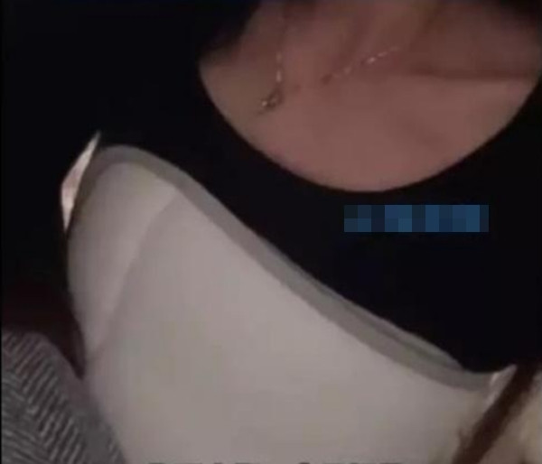 Cô Hoàng được băng bó sau khi khám. Ảnh: Weibo.