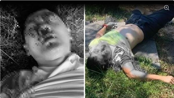 Lâm Chí Dĩnh có vẻ bị thương khá nghiêm trọng trong vụ tai nạn. Ảnh: 8 days.