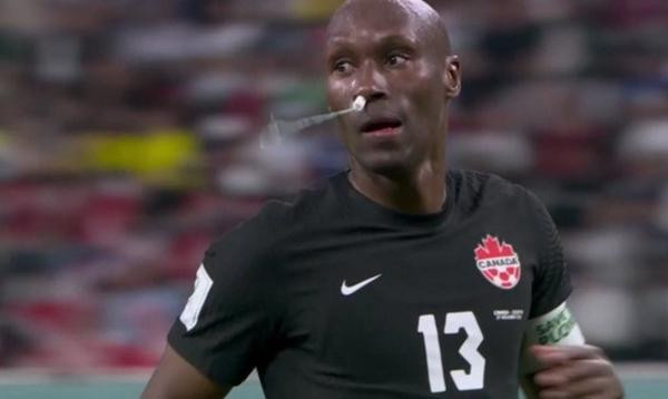 Vậy là đội trưởng đội tuyển Canada đã dùng một chiếc tampon để ngăn chảy máu mũi. Ảnh: BBC Sport. Vậy là đội trưởng đội tuyển Canada đã dùng một chiếc tampon để ngăn chảy máu mũi. Ảnh: BBC Sport.