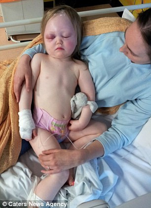 Cô bé bên mẹ sau khi được phẫu thuật.. Cô bé bên mẹ sau khi được phẫu thuật.